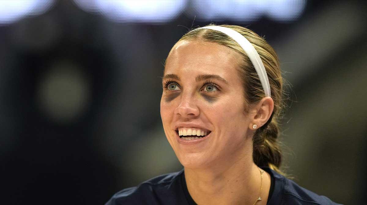 Indiana Fever guard Lexie Hull (10) warms up with two black eyes before the game against the Golden State Valkyries at Chase Center.